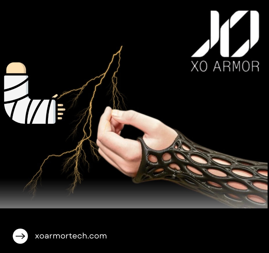 The progression of casting methods through a historical lens