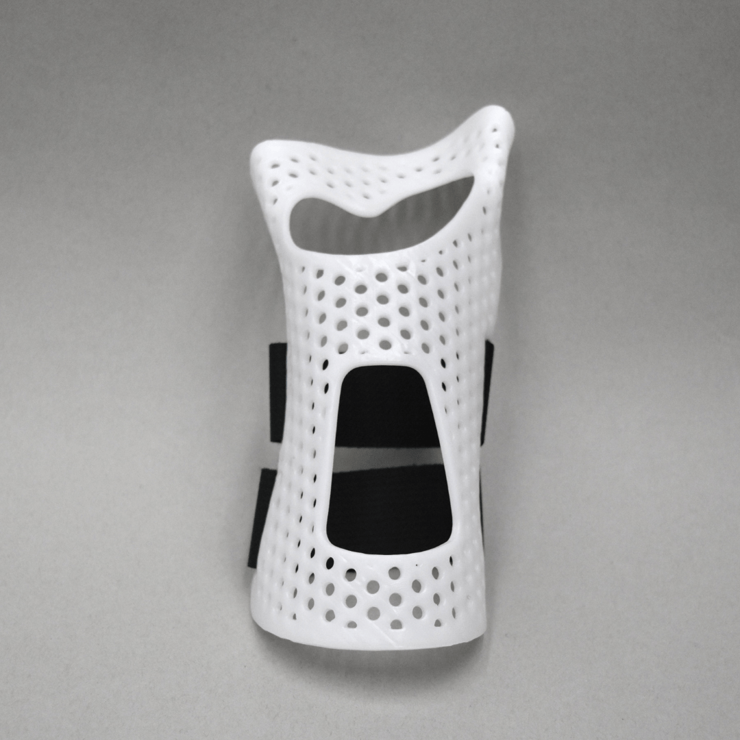 Dorsal Cockup Splint