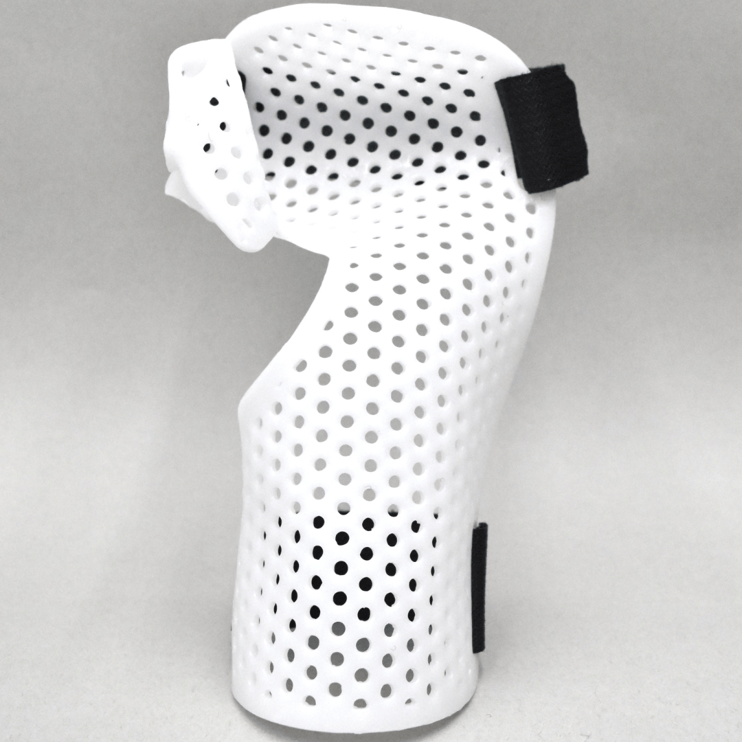 Intrinsic Resting Hand Splint