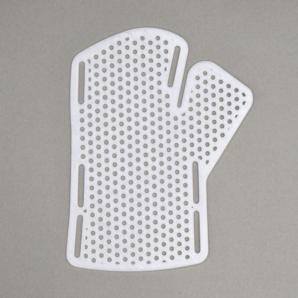 Rheumatoid Arthritis Hand Splint