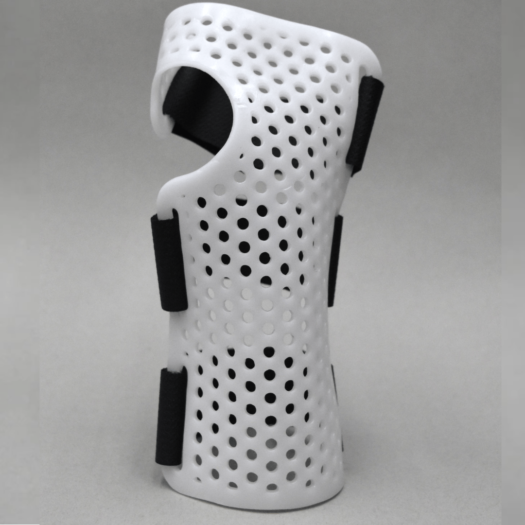 Wrist Cockup Splint with Radial Bar