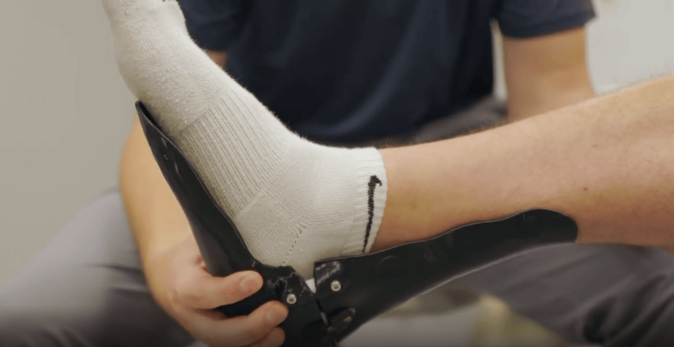 Load video: This video shows a patient testimonial sharing a success story of using XO Armor's custom-fit AFO
