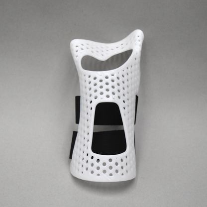 Dorsal Cockup Splint