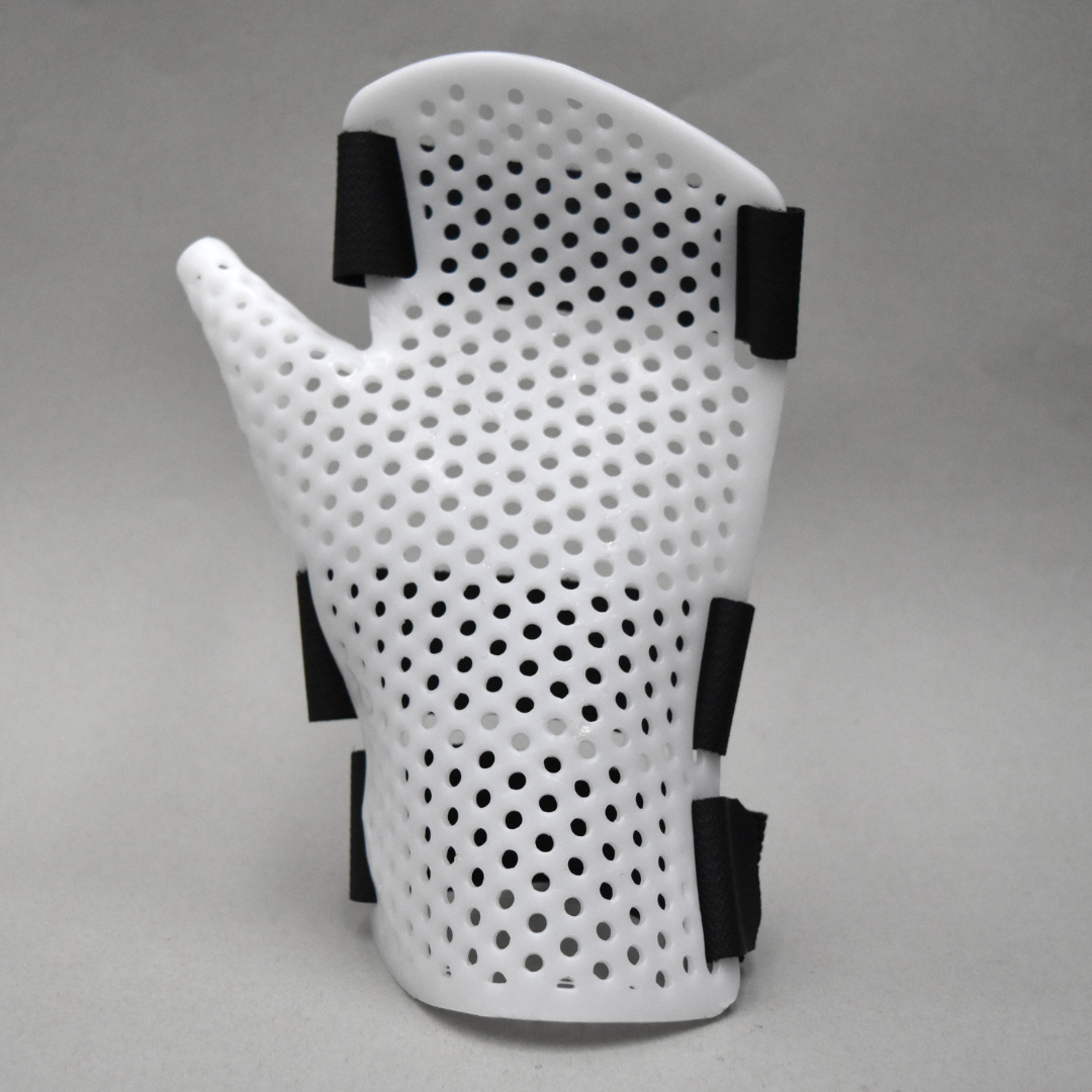 Rheumatoid Arthritis Hand Splint