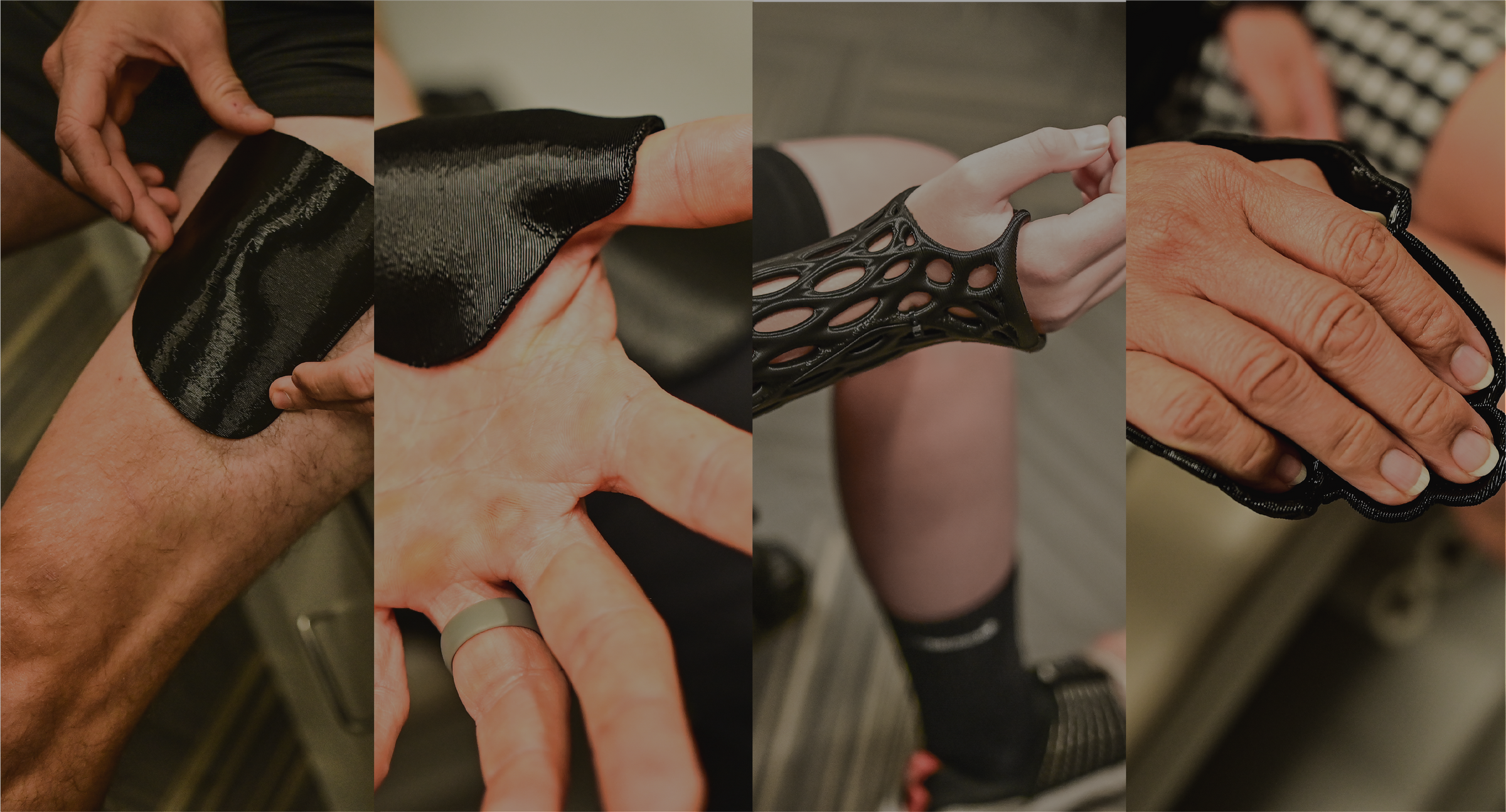 XO Armor's 3D printed guards, braces, and splints, showcasing custom-fit injury protection for various needs.