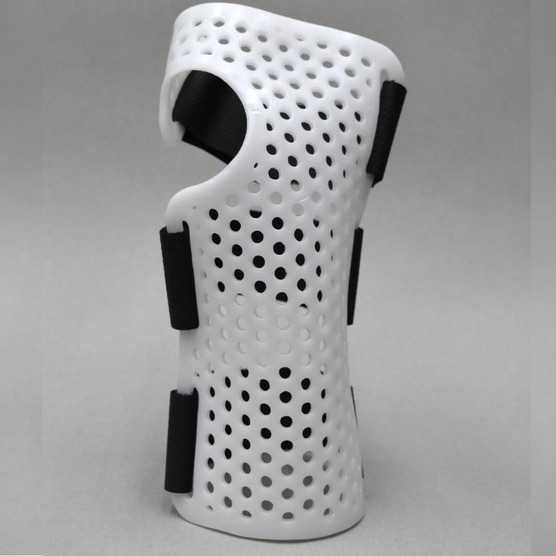 Wrist Cockup Splint with Radial Bar